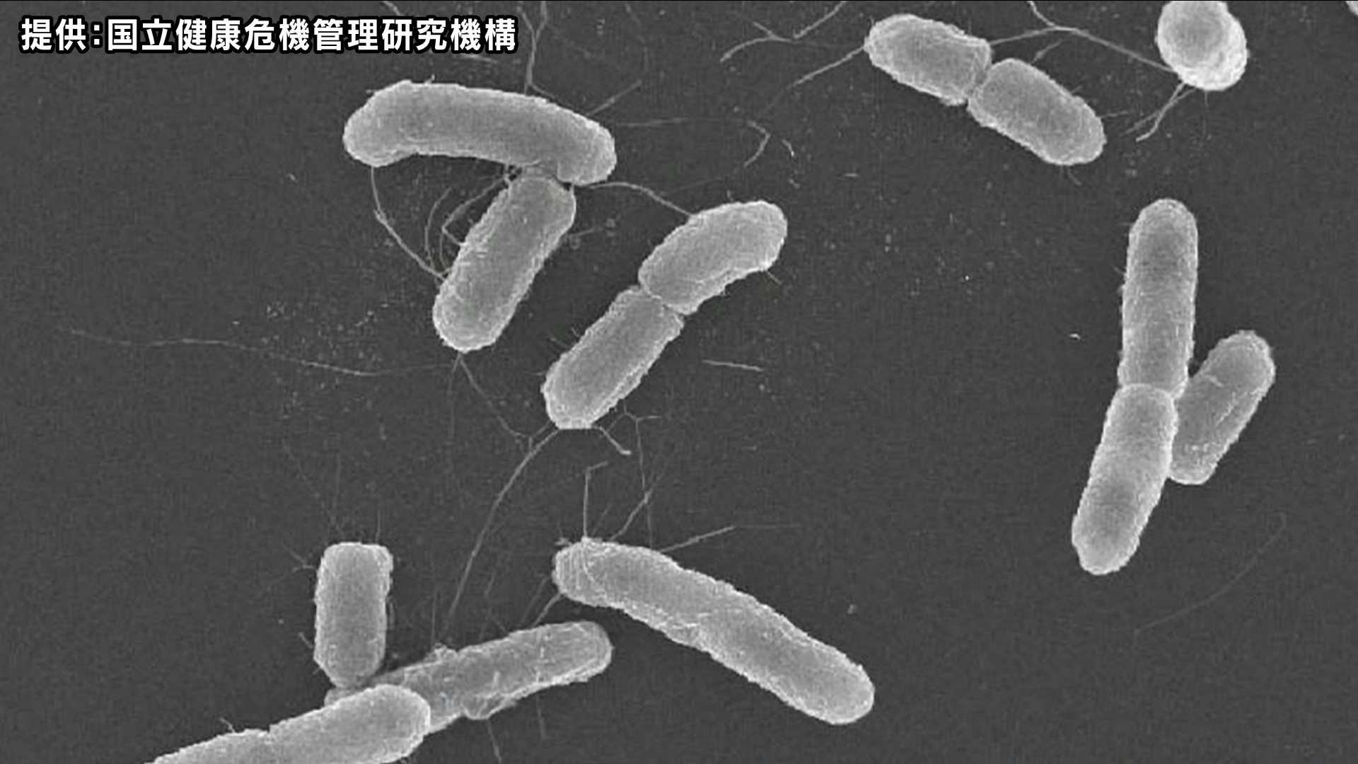 【速報】高校生5人が「O157」で入院　長野から沖縄への修学旅行で感染か　生徒と教職員計41人が腹痛、下痢など胃腸炎症状　旅行中の食事を中心に調査