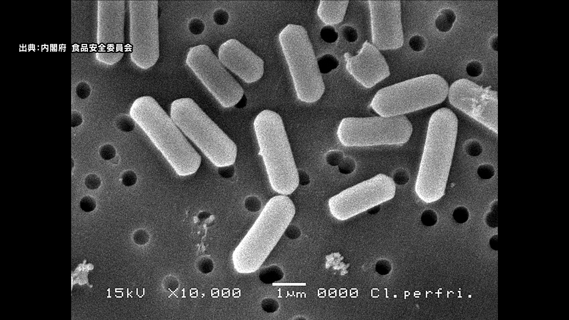 20～50代の男女18人「ウエルシュ菌」による食中毒　宿泊施設でバイキング形式で提供された夕食を食べる　宿泊施設は3日間営業停止に　長野・上田市