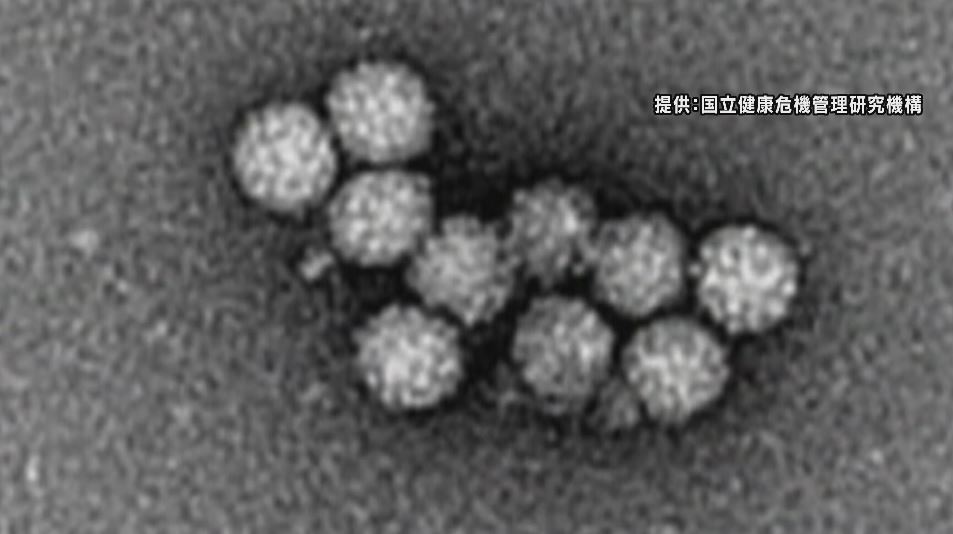 患者が急増…全県に「ノロウイルス食中毒注意報」　長野県