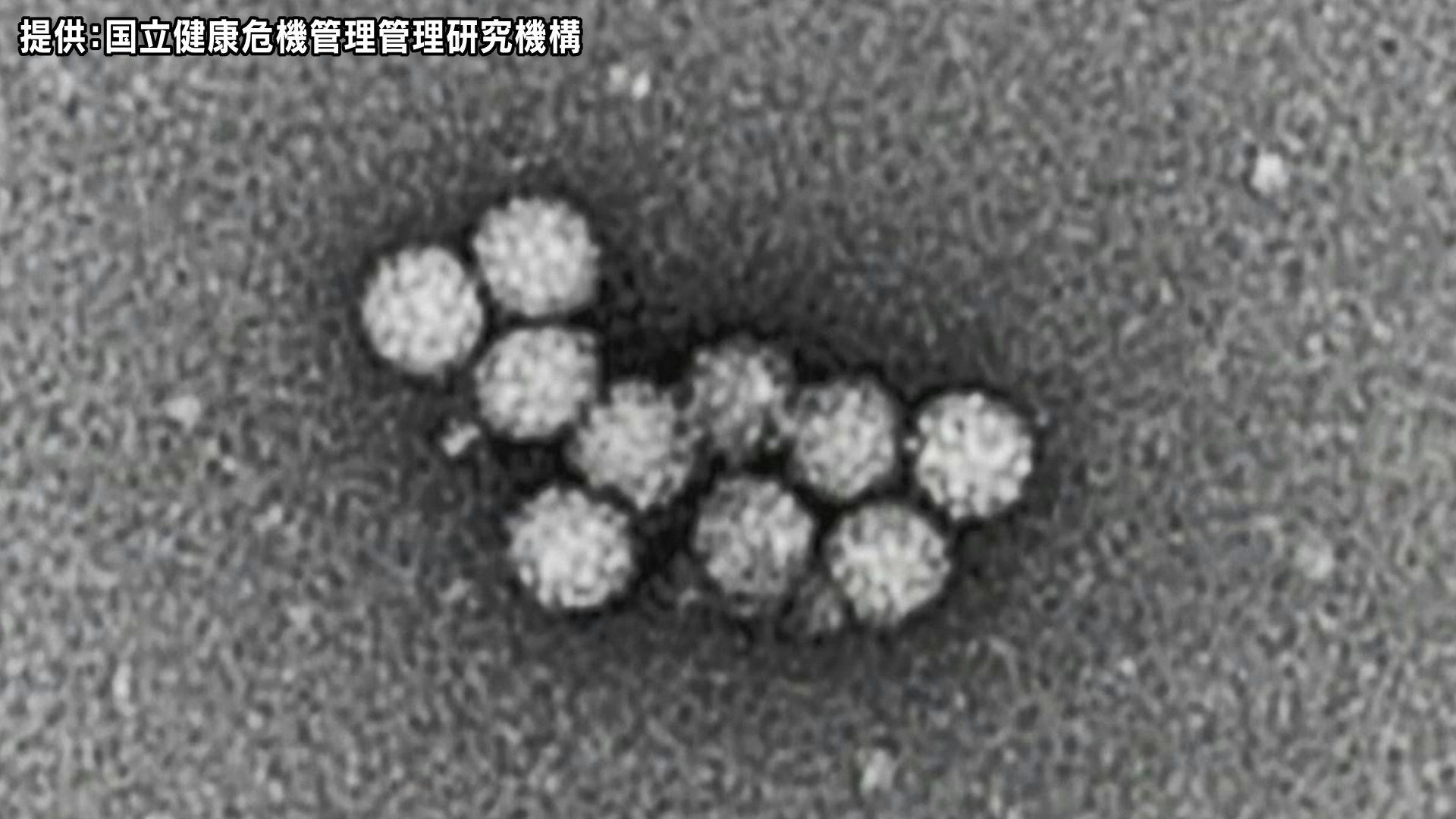 ウィンタースポーツの合宿で来た中学生18人に嘔吐、下痢などの症状　長野・野沢温泉村の旅館でノロウイルスによる食中毒が発生　患者と調理従事者の便からウイルスを検出