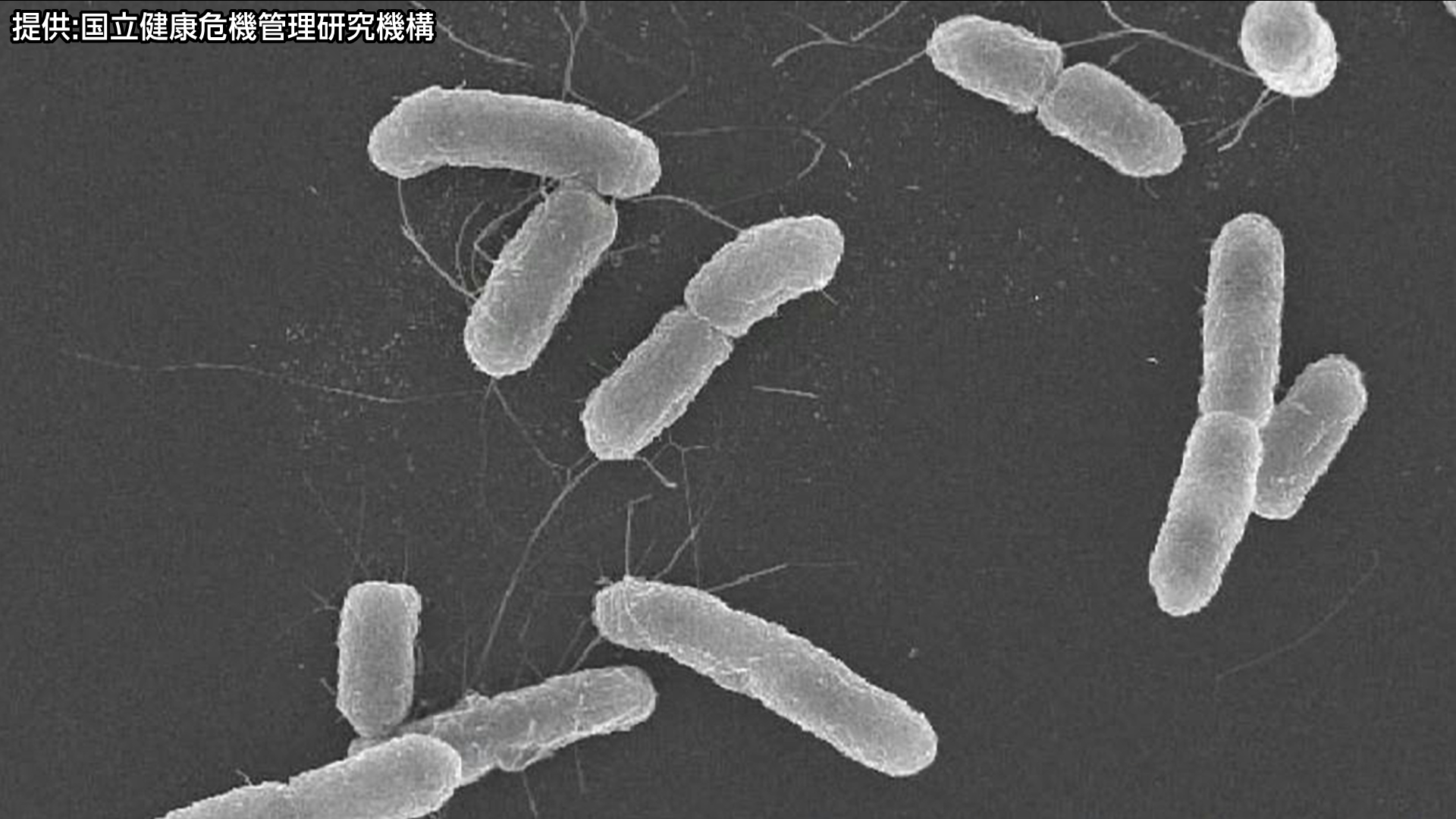 焼肉店で「O157」による食中毒　上タン、上ロース、白センマイ刺し、冷麺を食べた30代男性と40代女性が腹痛や下痢など症状　特徴・症状・予防方法は　長野市